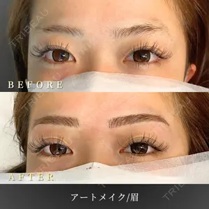 BiBiクリニックの症例