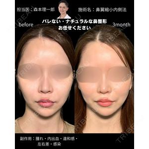 PRISM Beauty Clinic 町田院 森本 理一郎医師の症例