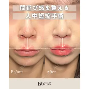 BITO BEAUTY CLINIC 伊藤 富良野医師の症例