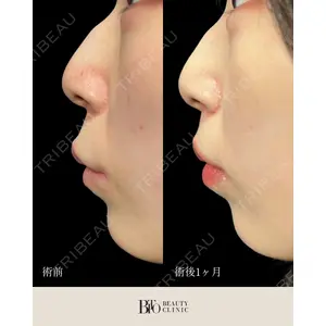 BITO BEAUTY CLINIC 伊藤 富良野医師の症例