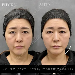 RIVER CLINIC（リバークリニック）大阪院の症例