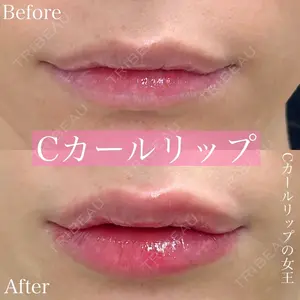 ルラ美容クリニック 渋谷本院 昼間 路子医師の症例