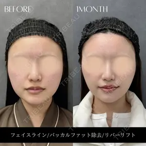 RIVER CLINIC（リバークリニック）大阪院の症例