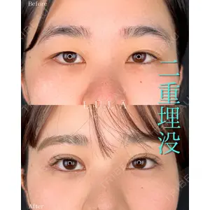 ルラ美容クリニック 町田院 松岡 舟作医師の症例