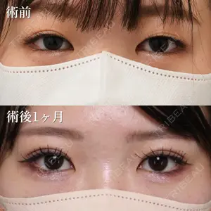 NARU Beauty Clinic 【ナルクリ】の症例