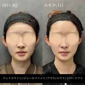 RIVER CLINIC（リバークリニック）大阪院の症例