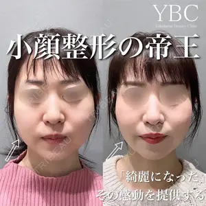 YBC横浜美容外科 大宮院 磯村 亮輔医師の症例