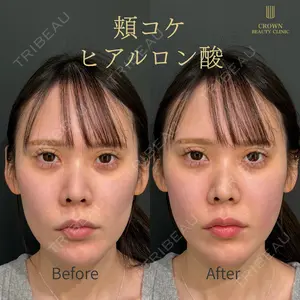 CROWN BEAUTY CLINIC 神山 豊医師の症例