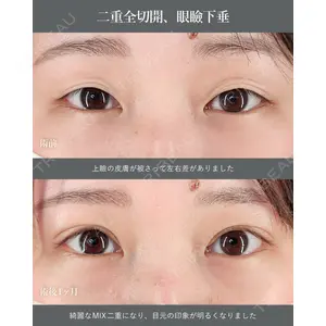 Tokyo Tensei Clinic 大阪梅田院 岩本優輝医師の症例