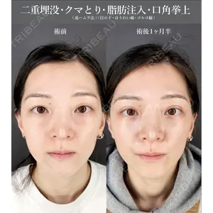 Tokyo Tensei Clinic 大阪梅田院 岩本優輝医師の症例