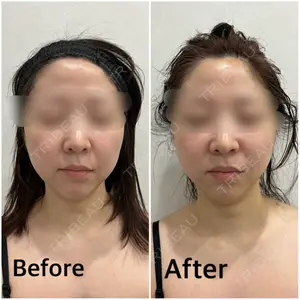 GRACY TOKYO CLINIC【グレイシートウキョウクリニック】 江本 正樹医師の症例