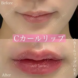 ルラ美容クリニック 渋谷本院 昼間 路子医師の症例