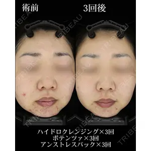 HAAB BEAUTY CLINIC 名古屋院の症例