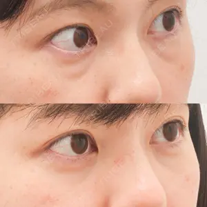 東京イセアクリニック 権東　容秀医師の症例