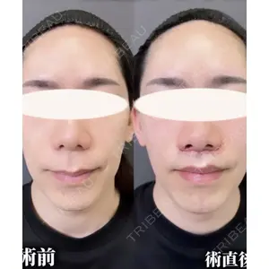 plume clinic 向山 綾子医師の症例