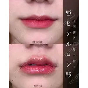 ルラ美容クリニック 大宮院 / ルラスキンクリニック 大宮院 右京 大季医師の症例