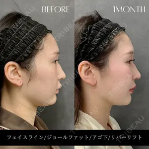 RIVER CLINIC（リバークリニック）大阪院の症例