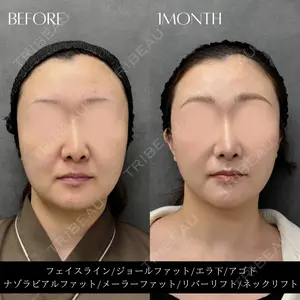 RIVER CLINIC（リバークリニック）大阪院の症例