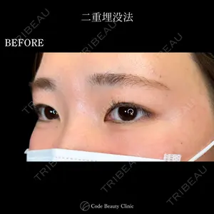 Code Beauty Clinic 名古屋院 橋本 祥平医師の症例