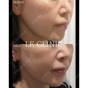 LE CLINICの症例