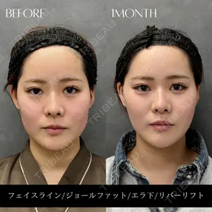 RIVER CLINIC（リバークリニック）大阪院の症例