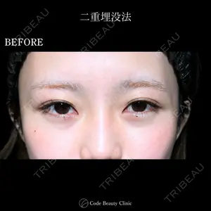 Code Beauty Clinic 名古屋院 橋本 祥平医師の症例