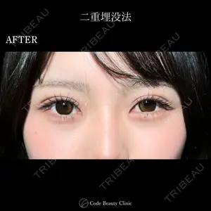 Code Beauty Clinic 名古屋院 橋本 祥平医師の症例