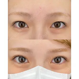 EMMO FACE CLINIC 大宮院 廣松 直樹医師の症例
