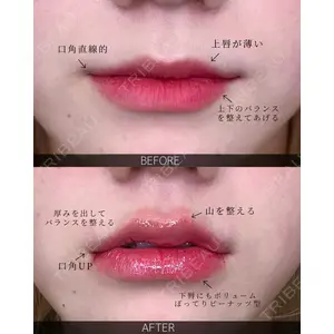 ルラ美容クリニック 大宮院 / ルラスキンクリニック 大宮院 右京 大季医師の症例