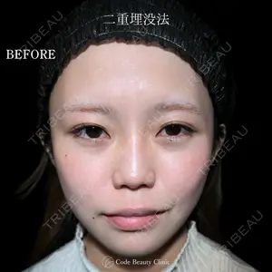 Code Beauty Clinic 名古屋院 橋本 祥平医師の症例