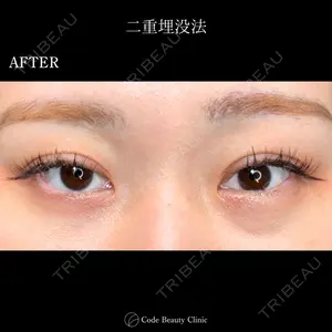 Code Beauty Clinic 名古屋院 橋本 祥平医師の症例