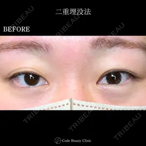 Code Beauty Clinic 名古屋院 橋本 祥平医師の症例