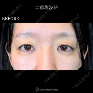 Code Beauty Clinic 名古屋院 橋本 祥平医師の症例