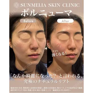 SUNMELIA SKIN CLINICの症例