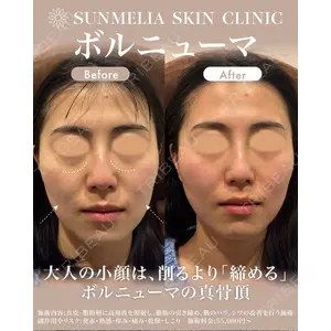 SUNMELIA SKIN CLINICの症例