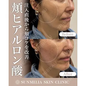 SUNMELIA SKIN CLINICの症例