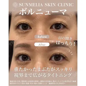 SUNMELIA SKIN CLINICの症例