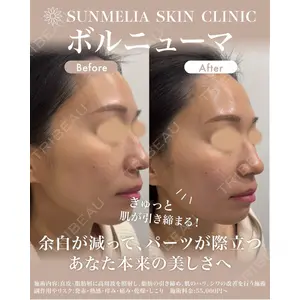 SUNMELIA SKIN CLINICの症例