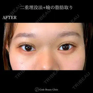 Code Beauty Clinic 名古屋院 橋本 祥平医師の症例