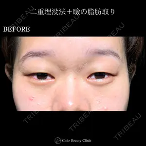 Code Beauty Clinic 名古屋院 橋本 祥平医師の症例
