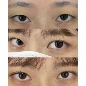 EMMO FACE CLINIC 大宮院 廣松 直樹医師の症例