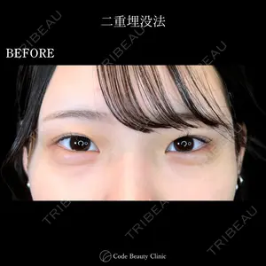 Code Beauty Clinic 名古屋院 橋本 祥平医師の症例