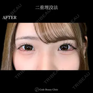 Code Beauty Clinic 名古屋院 橋本 祥平医師の症例