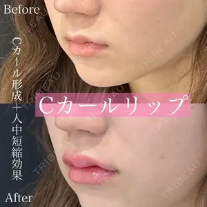 ルラ美容クリニック 渋谷本院 昼間 路子医師の症例