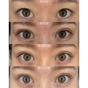 EMMO FACE CLINIC 大宮院 廣松 直樹医師の症例
