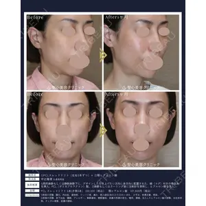 聖心美容クリニック 広島院 中辻 隆徳医師の症例