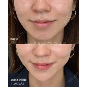 Mavie Beauty Clinic （マヴィービューティークリニック）の症例