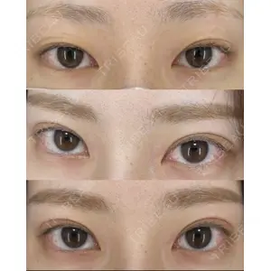 EMMO FACE CLINIC 大宮院 廣松 直樹医師の症例