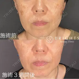 BRIGHTS beauty clinic 今村 直樹医師の症例