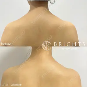 BRIGHTS beauty clinic 今村 直樹医師の症例